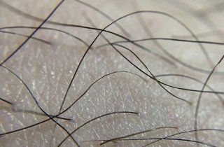 体毛の夢占い