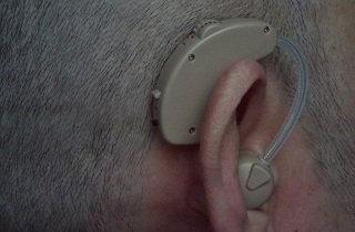 補聴器の夢占い